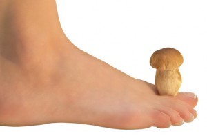 Fußpilz: Symbolisches Bild mit einem Champion auf dem Fuß